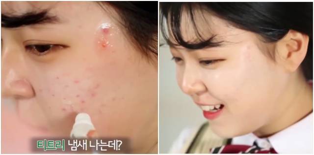 real skin patch怎么樣？real skin是什么牌子