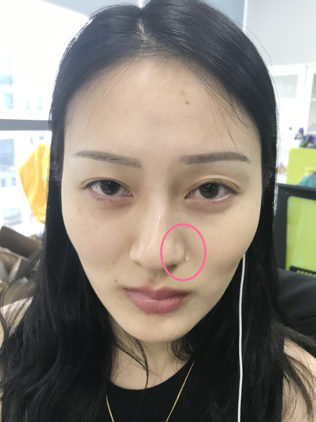 real skin patch怎么樣？real skin是什么牌子