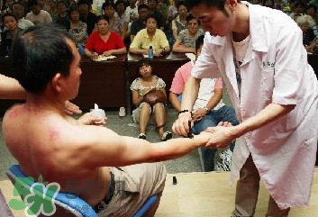 刮痧痛嗎？刮痧疼還是拔罐疼