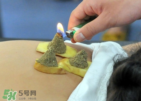 三伏灸有用嗎？2017年三伏艾灸時(shí)間