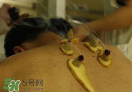 三伏灸有用嗎？2017年三伏艾灸時(shí)間