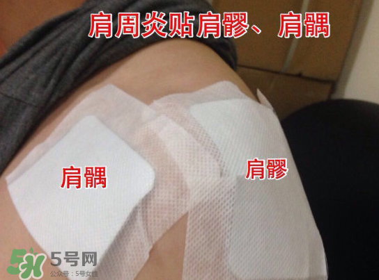 艾灸貼多少錢(qián)一盒?？艾灸貼一盒60裝多少錢(qián)？