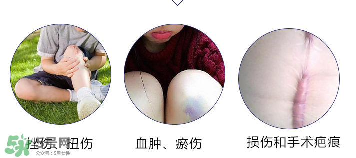 hirudoid除疤膏有效嗎？hirudoid去疤膏效果如何？