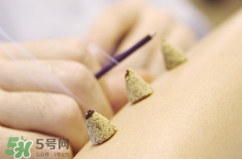 三伏貼和艾灸哪個(gè)好？三伏貼和艾灸區(qū)別