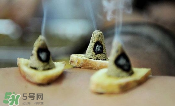 貼三伏貼可以艾灸嗎？貼三伏貼多久可以艾灸