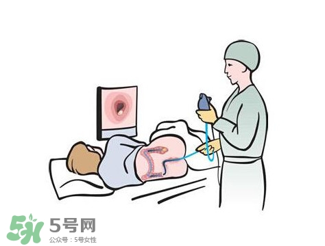 直腸癌怎么查出來的？直腸癌怎么判斷早晚期