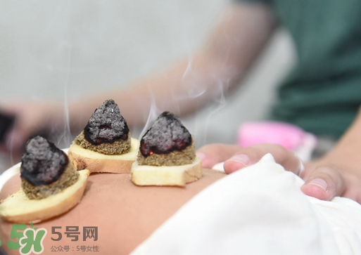 三伏灸什么人不能做？三伏灸適合哪些人？