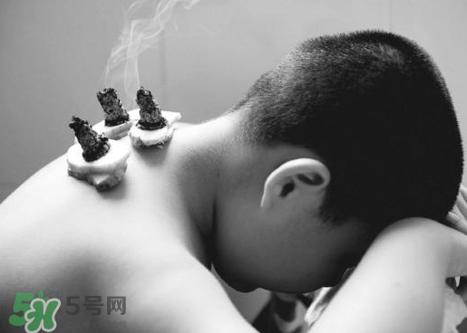 三伏灸什么人不能做？三伏灸適合哪些人？