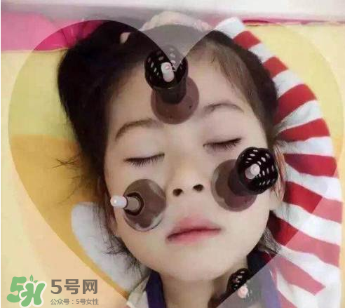 艾灸貼可以治咳嗽嗎？艾灸貼可以治退燒嗎？