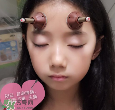 艾灸貼可以治咳嗽嗎？艾灸貼可以治退燒嗎？