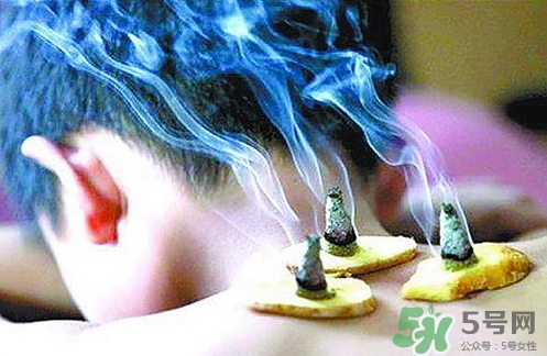 三伏灸什么時(shí)候開(kāi)始灸？三伏灸怎么灸？