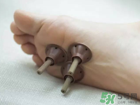 艾艾貼灸出水珠為什么？艾艾貼后有水珠要擦嗎？