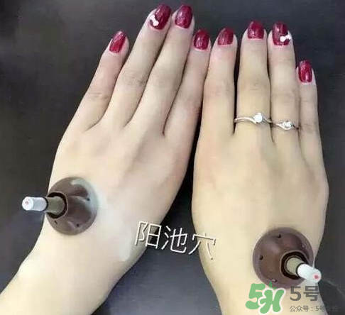 艾艾貼灸出水珠為什么？艾艾貼后有水珠要擦嗎？