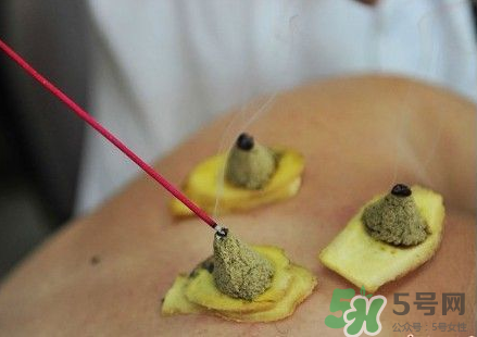 三伏灸可以自己灸嗎？三伏灸可以在家做嗎？
