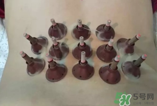 艾艾貼可以貼肚臍眼嗎？艾艾貼貼肚臍有什么作用？