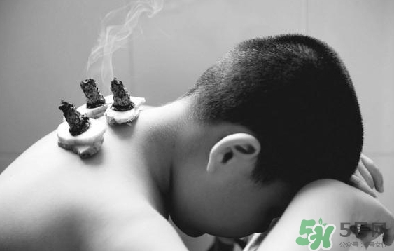 三伏灸要灸幾次？三伏灸要灸多久？