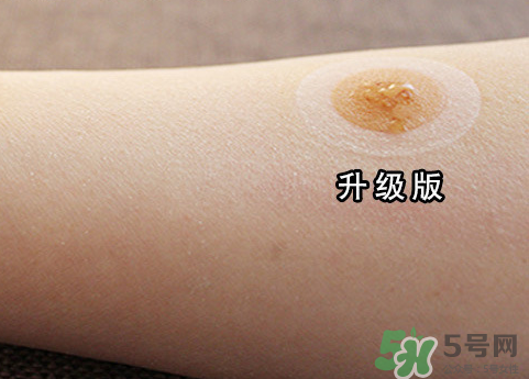 艾灸貼后有水泡怎么辦？貼艾灸貼應注意些什么？