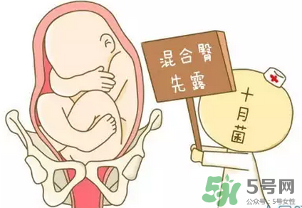 胎位不正能順產(chǎn)嗎？胎位不正怎么辦？