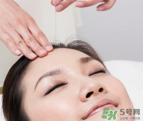 中醫(yī)院針灸一次多少錢？針灸后疼痛加重正常嗎
