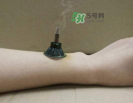 三伏天下雨可以艾灸嗎？三伏天下雨艾灸好嗎？