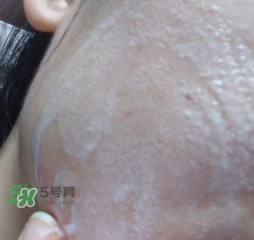 貝蜜清凈痘控油潔面啫喱怎么樣？貝蜜清祛痘控油潔面啫喱好用嗎？