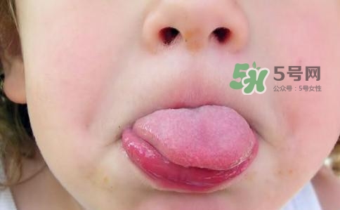 三伏天為什么濕氣重？三伏天為什么要注意祛濕？