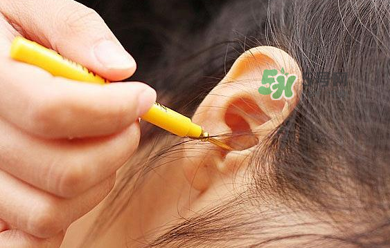 兒童耳屎成硬塊怎么辦？?jī)和撼捎矇K有危害嗎？