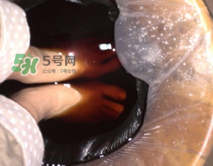 醋泡腳用白醋還是陳醋？泡腳用什么醋最好？