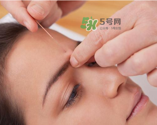 三伏天針灸有什么好處？三伏天針灸注意什么？