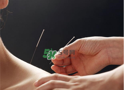 三伏天針灸有什么好處？三伏天針灸注意什么？