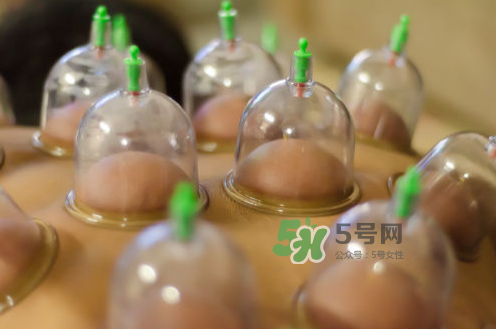 拔火罐是夏天好還是冬天好？什么時(shí)候拔火罐最合適？
