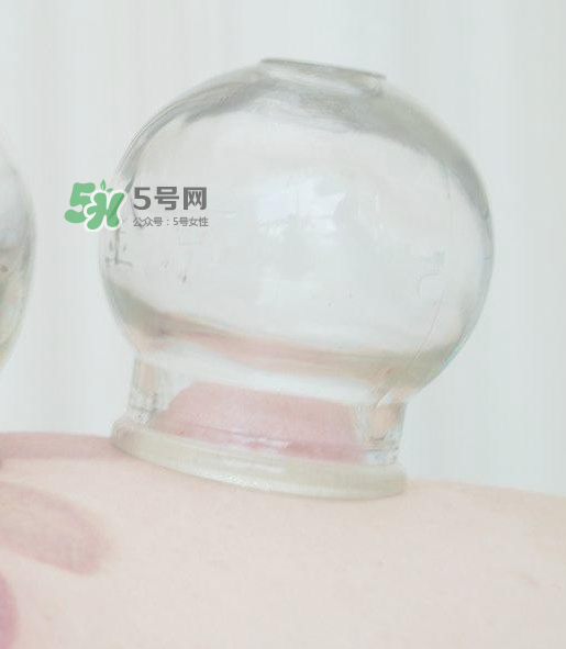 拔火罐一次多長(zhǎng)時(shí)間？拔火罐一般多長(zhǎng)時(shí)間？