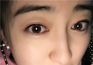做美瞳線會(huì)不會(huì)掉睫毛？做美瞳線掉睫毛怎么辦？