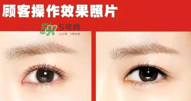 美瞳線有必要做嗎？做美瞳線多少錢？