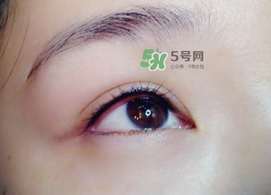 做美瞳線疼嗎？做美瞳線后要注意什么？