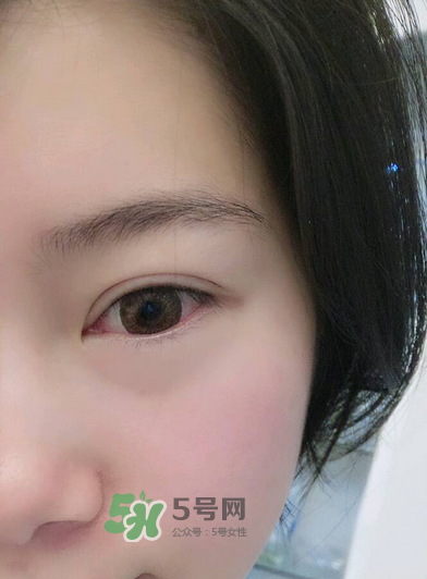 做美瞳線疼嗎？做美瞳線后要注意什么？