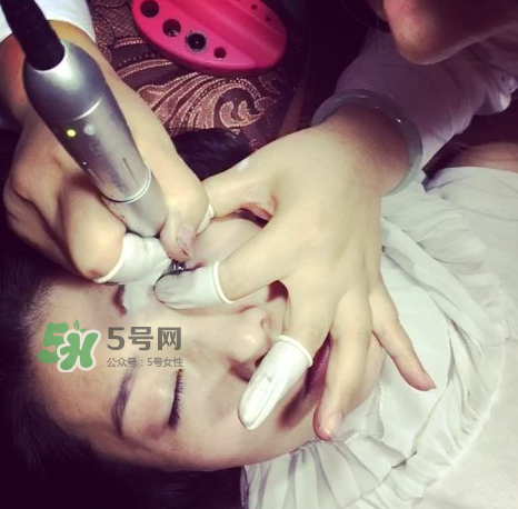 做美瞳線要打麻藥嗎？做美瞳線麻藥怎么敷？