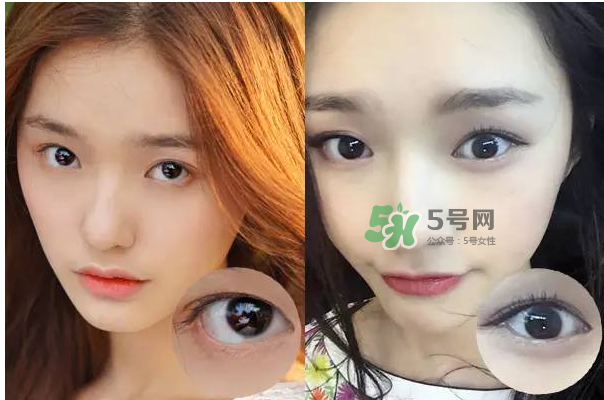 做美瞳線會(huì)不會(huì)掉睫毛？做美瞳線掉睫毛怎么辦？
