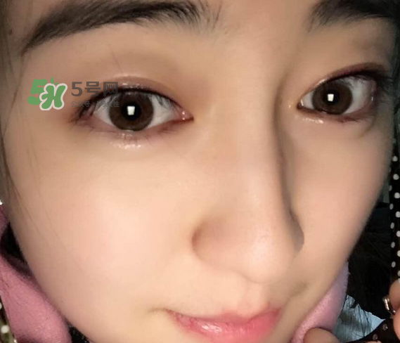 做美瞳線可以喝酒嗎？做美瞳線喝酒有影響嗎？