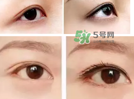 做美瞳線可以吃雞蛋嗎？做美瞳線能吃雞蛋嗎？