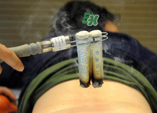 三伏天艾灸后能吹空調(diào)嗎？三伏天艾灸后能吹電扇嗎？
