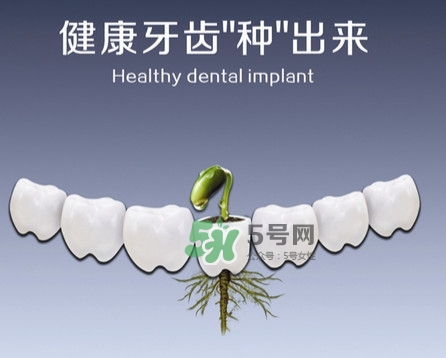 種植牙費(fèi)用多少錢(qián)？國(guó)產(chǎn)種植牙價(jià)格