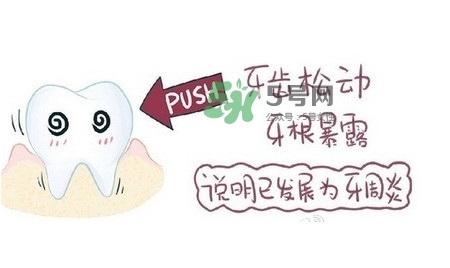 牙齒松動(dòng)會(huì)自己好嗎？牙齒松動(dòng)會(huì)自己掉嗎