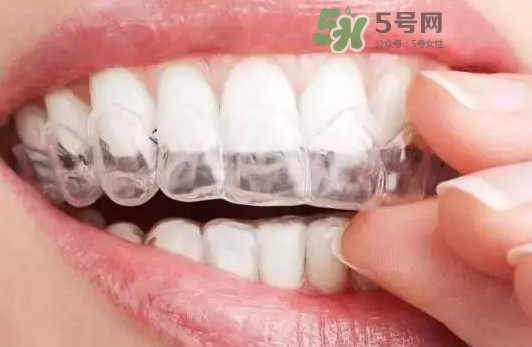 牙齒有縫隙可以補(bǔ)嗎？牙齒縫隙大能補(bǔ)嗎