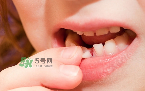牙齒松動(dòng)可以重新長(zhǎng)牢固嗎？牙齒松動(dòng)可以修復(fù)嗎