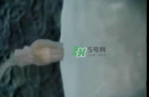 懷孕初期怎么保胎？陰道出血是流產(chǎn)征兆嗎？