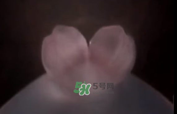 懷孕初期怎么保胎？陰道出血是流產(chǎn)征兆嗎？