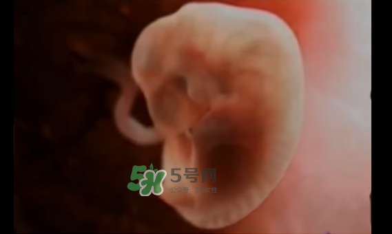 懷孕初期怎么保胎？陰道出血是流產(chǎn)征兆嗎？