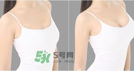 女性乳頭癢是怎么回事？女性乳頭癢要怎么治療？