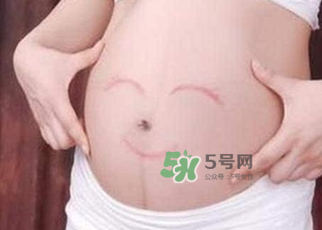 產(chǎn)婦胃脹氣怎么緩解？產(chǎn)婦胃脹氣怎么辦？